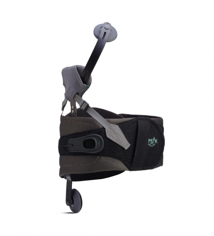 Peak Scoliosis Side view